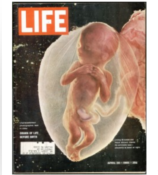 Bambino non ancora nato di Life. La copertina da 8 milioni di copie che ci ricorda che siamo tutti esseri umani 1